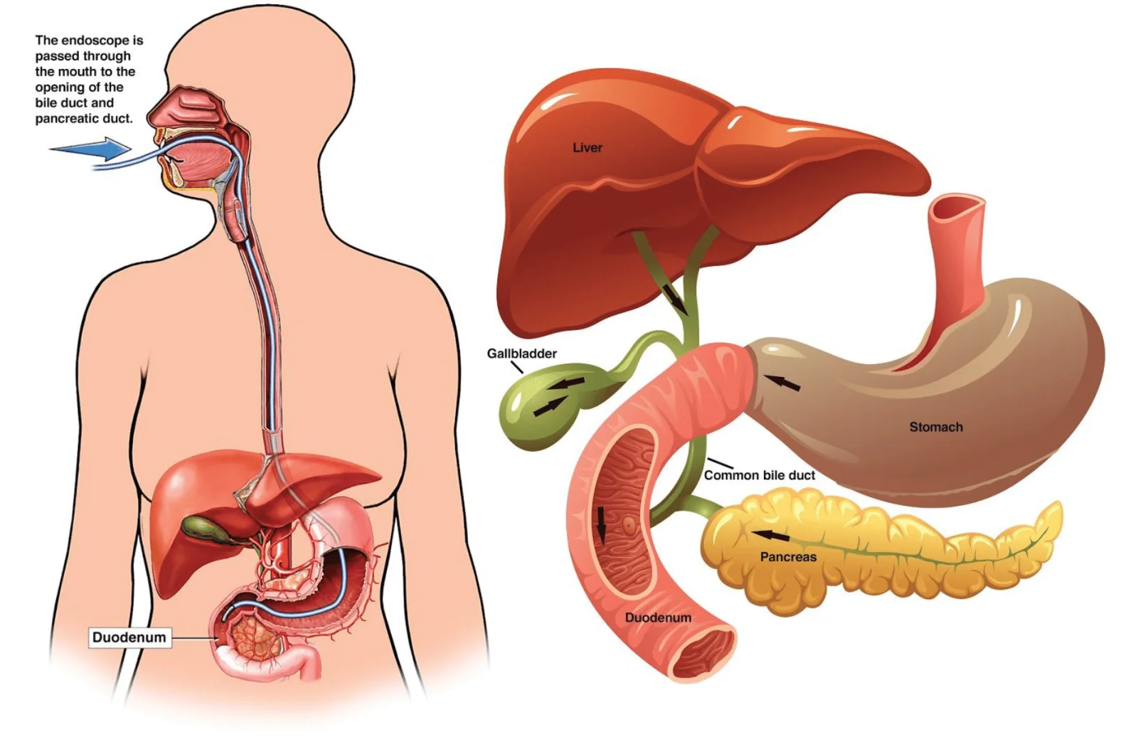 ERCP Procedure