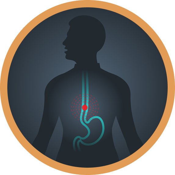 Esophageal/Colonic Metallic Stent Placement