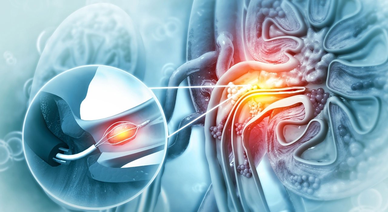 Foreign Body Removal Image