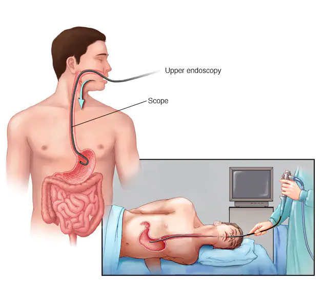 Diagnostic Endoscopy Image