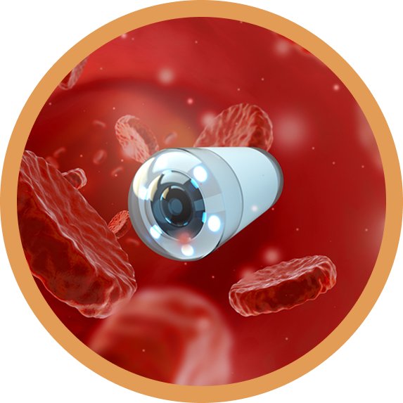 Video Capsule Endoscopy